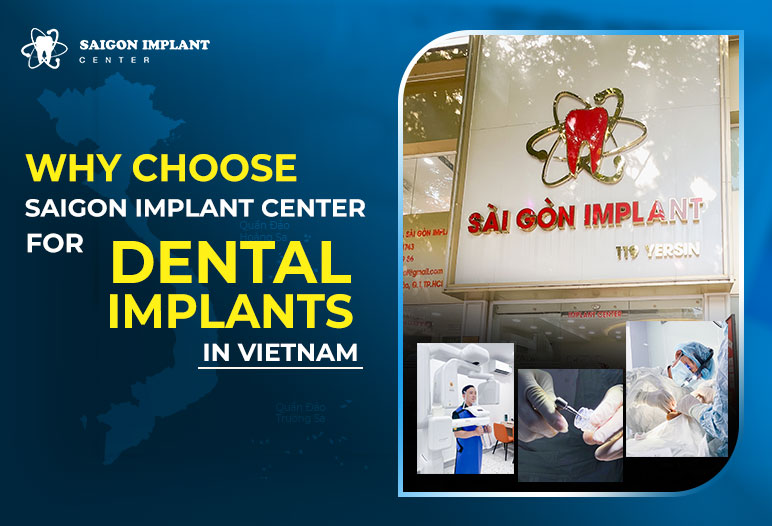 why choose saigon implant center ho chi minh