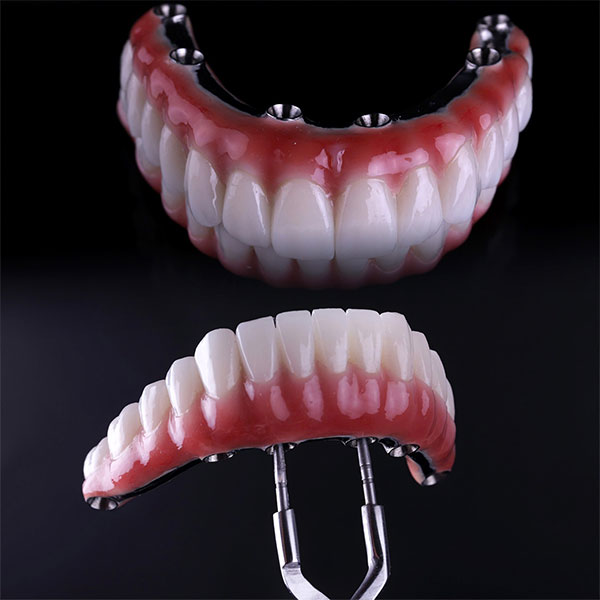 zirconia full-arch bridge implants
