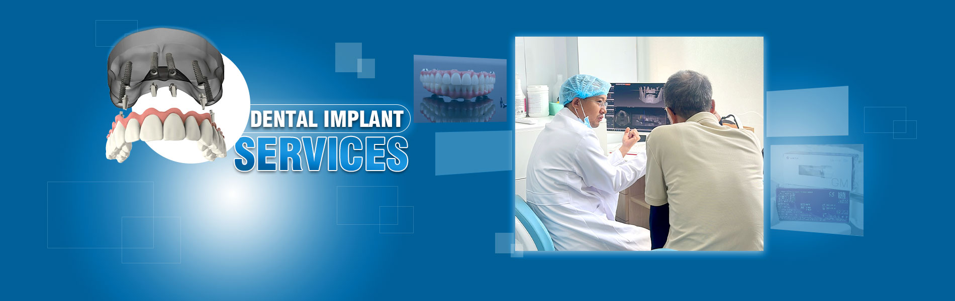 dental implant services